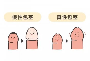 包茎手术有哪些并发症